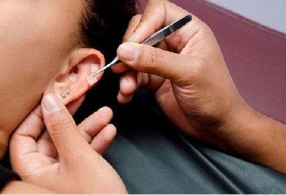Auriculoterapia: imagen del catálogo de Vianka Pradena